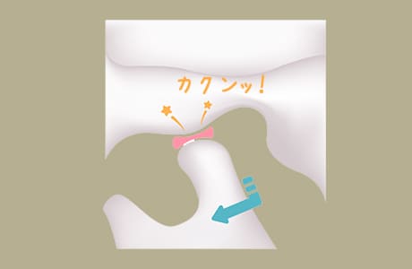 引っかかりが外れて下顎頭がさらに前へ出るときにカクンと音が出る